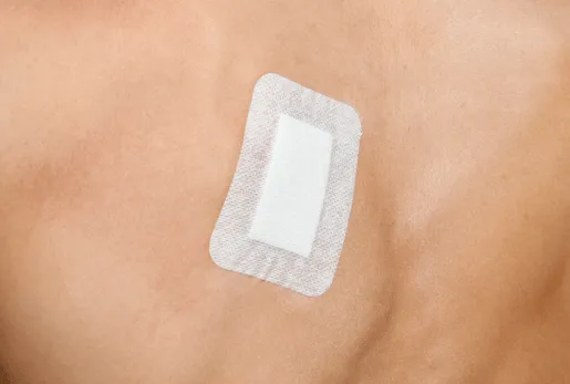 Adhesive Dressings - Steropore 25s